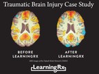 LearningRx Brain Training Celebrates 15 Years of Franchising With Lower Franchise Fees and Initial Investment