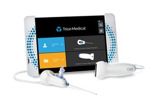 Trice Medical Launches the World's First Dynamic Imaging Platform, Adding Ultrasound Capability to the mi-eye®