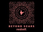 RealSelf Launches Beyond Scars: Healing Bodies. Restoring Lives. - A Global Effort To Address India's Burn Epidemic