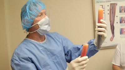 Dr. Andrew Rochman extracts stem cells from patient's body fat