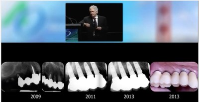 Dr. Oded Bahat, Beverly Hills Dental Implant Expert Delivers Craniofacial Changes Lecture