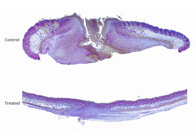 Mouse skin was burned and treated with either a standard burn treatment or new wound-healing therapy. After two weeks, cross sections of burned skin show control skin (top image) had clearly not healed, with no hair follicles, sebaceous glands or other higher order structures present in the burn area. Burns treated with therapeutic gel (bottom image) showed progressive healing and tissue regeneration, including new hair follicles.