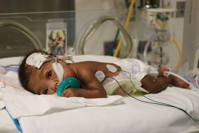 Preterm Infant in NYU Winthrop's Neonatal Intensive Care Unit. Cold milk is proving an effective therapy for preterm infants who have the feeding dysfunction, dysphagia. The cold milk startles the pharynx and triggers the brain to initiate more efficient swallowing movements.