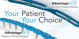 FDA Clears SIG Medical's AdvantageRib Anterior System