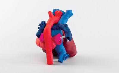 This 3D printed, patient-specific heart model helps surgeons view the patient’s anatomy in 3D, prior to surgery. This 3D printed, patient-specific heart model helps surgeons view the patient’s anatomy in 3D, prior to surgery.