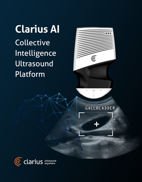 The Clarius AI solution focuses on data and image quality, ease of data collection, and a collaborative platform for both physicians and researchers to label and augment acquired images.