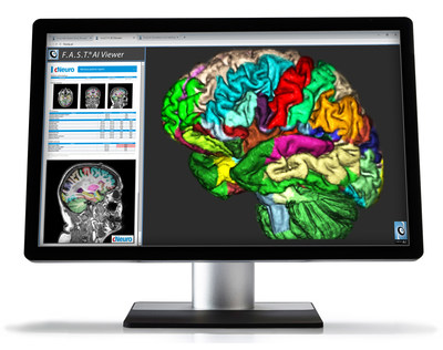 F.A.S.T.® AI Viewer powered by Fovia AI. Visualization for Artificial Intelligence, RSNA 2018.