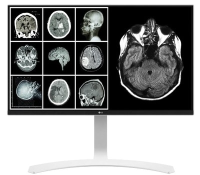LG’s 27-inch 8MP clinical review monitor features DICOM out-of-the-box calibration to ACR-AAPM-SIIM secondary review brightness guidelines, plus a backlight sensor that maintains DICOM calibrated brightness for three years. LG Electronics is expanding its U.S. medical imaging portfolio with a new high-performance 21-inch diagnostic monitor and two new FDA-approved digital x-ray detectors.