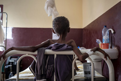 Des enfants souffrant de malnutrition svre aige reoivent des traitements dans une clinique pdiatrique soutenue par l'UNICEF  Bangui, Rpublique centrafricaine.  UNICEF/UN0239441/Gilbertson VII Photo (Groupe CNW/UNICEF Canada)