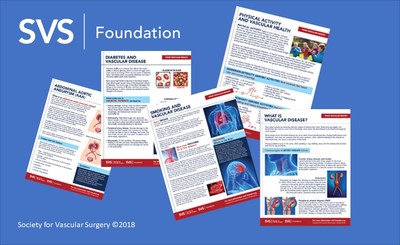 Newly updated patient information fliers on vascular health and diseases are now available for download from the Society for Vascular Surgery Foundation.