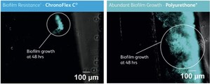 Access Scientific announces the first non-coated intravascular catheter material--ChronoFlex®C with BioGUARD™--proven in vitro to inhibit bacterial attachment and biofilm formation