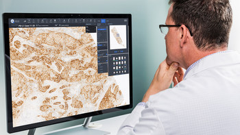 Roche launches uPath enterprise software with improved speed ...