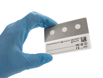 The cobas® Plasma Separation Card will reach beyond boundaries. This is the only CE-marked plasma sample collection devise which is stable under high heat and humid conditions and provides results that correlate well to traditional quantitative plasma based testing which is considered the gold standard sample type for monitoring patient’s response to treatment.
