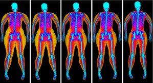 Bodyscan: 6,000 Scans Show Fat Mass Index (FMI) Is the True Measure of Body Fat