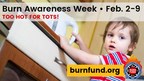 Burn Awareness Week to highlight top burn hazards for young children
