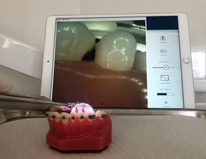 OmniVision's Wafer-Level Camera Module Enables Breakthrough Smart Dental Mirror