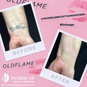 Invisible Ink Tattoo Removers: Give Us Your Old Flames &amp; We'll Give You Up to $500 This Valentine's Season