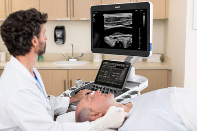 The Ultimate Ultrasound Solution for Vascular Assessment allows clinicians to make confident assessment and diagnosis of vascular conditions through easy to interpret images.