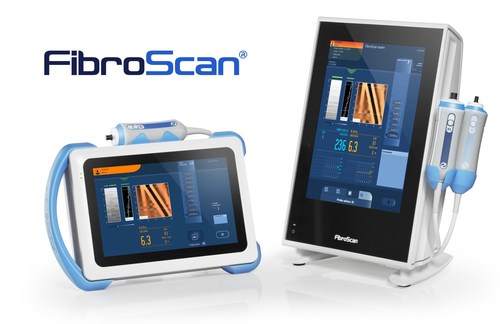 FibroScan® devices (PRNewsfoto/Echosens)