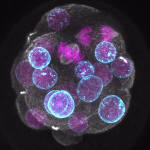 Making better embryos - CRCHUM researchers have made a breakthrough related to infertility