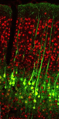 Apical dendrites extending from neurons (green) into layer 1 of the somatosensory cortex (Credit: Bruno lab/Columbia's Zuckerman Institute).