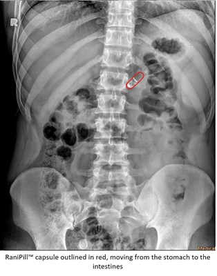 RaniPill™ capsule outlined in red, moving from the stomach to the intestines