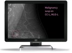 Kheiron launches Mia™, winner of Aunt Minnie's  'Best New Radiology Software'