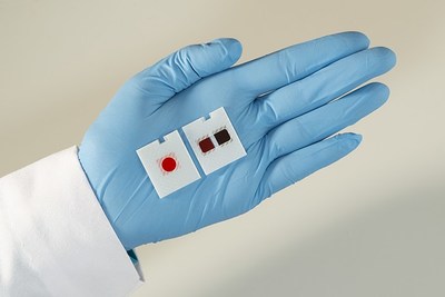 Ortho Clinical Diagnostics’ VITROS® XT MicroSlide (right) is a new multi-test technology that allows labs to run two tests simultaneously.