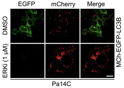 Unexpectedly, blocking signaling from mutant KRAS led to an increase in autophagy, as shown by the increase in red staining and decrease in green in the ERKi row.