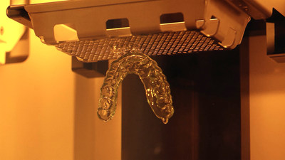 Splint produced on 3D Systems' NextDent 5100 with NextDent Ortho Rigid material.