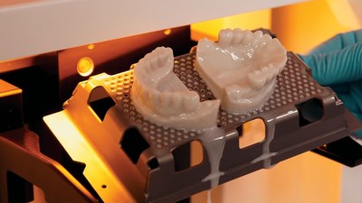 Mills can 3D print palatal jigs on the NextDent 5100 at less than half the cost of milling.