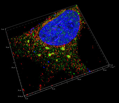 3D projection showing TIA+ stress granules in cytoplasm (relatively large yellow structures outside of nucleus (in blue) (Credit: Joseph Rayman/Kandel lab/Columbia's Zuckerman Institute).