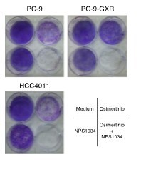 Kanazawa University Research: Origin of Resistance to Lung-cancer Drug Discovered