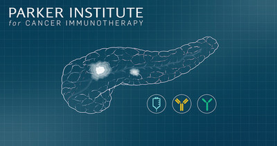 A combination of immunotherapy and chemotherapy shrank tumors in advanced pancreatic cancer patients, according to early study results being presented March 31. The trial was conducted by the Parker Institute for Cancer Immunotherapy and its partners.