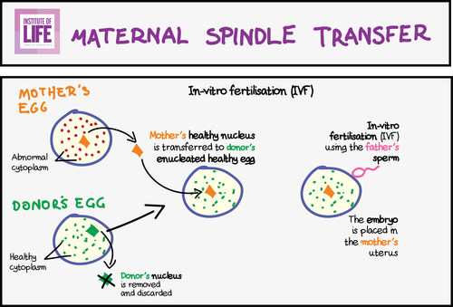 Maternal Spindle Transfer