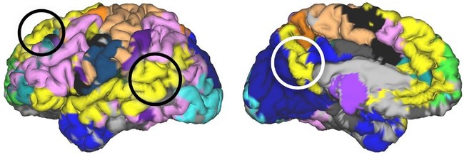 The yellow regions are part of the memory network. The region in the white circle is too deep to be affected by neurostimulation. We are targeting the connected region (in the black circle).