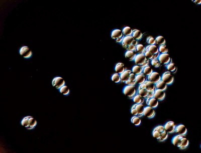 A bright field image shows the accumulation of large oil droplets forming within individual microalgae cells at Checkerspot laboratories. From an evolutionary perspective, algae evolved to produce oil as a matter of survival. Checkerspot takes advantage of this by growing its algae in fermentation (like yeast to make beer) and feeding it sugar, the algae metabolizes it in days and accumulates large amounts of oil within its cells.