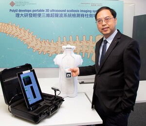 PolyU Develops Palm-sized 3D Ultrasound Imaging System for Scoliosis Mass Screening and Frequent Monitoring