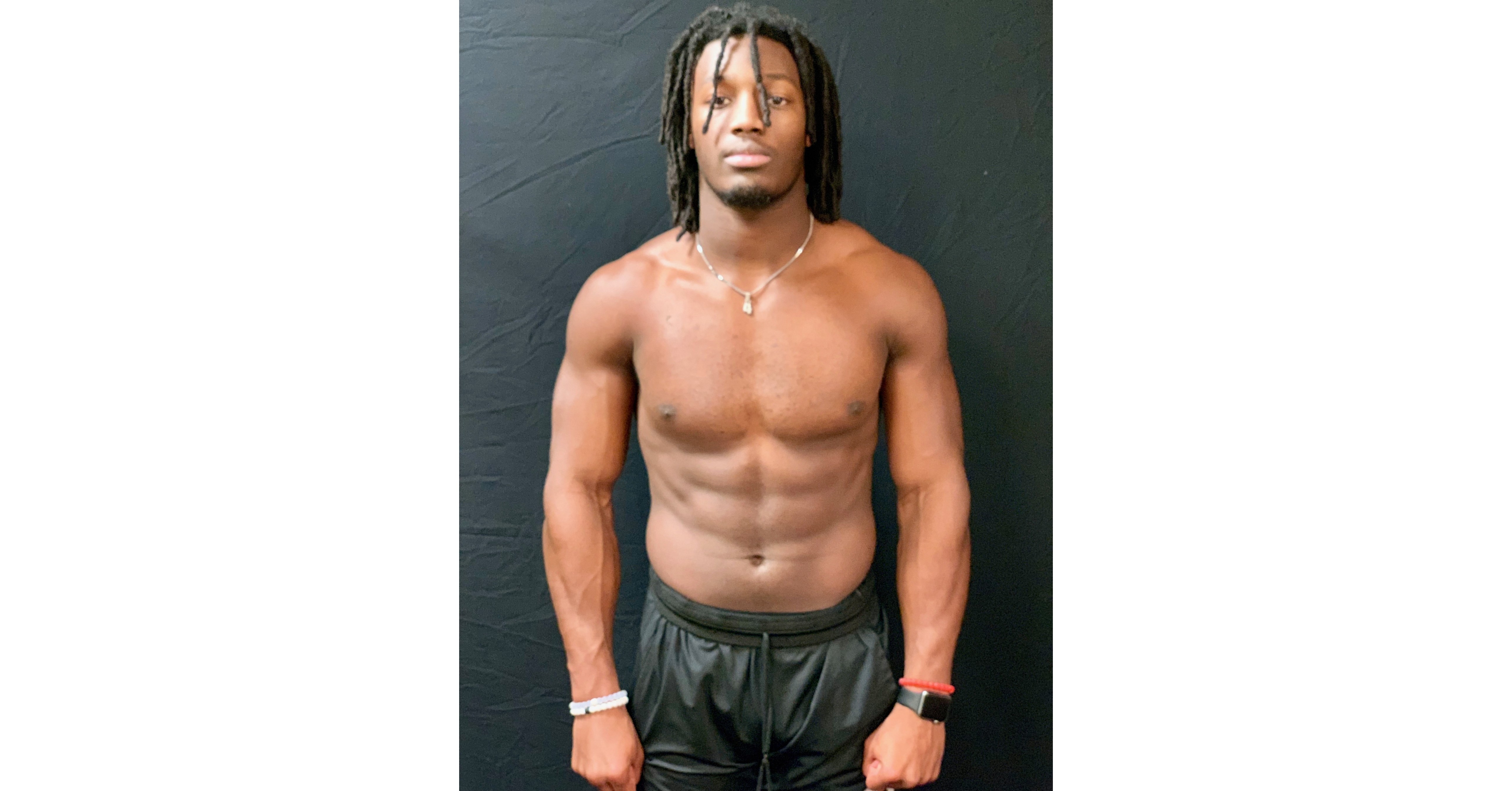 Team CarnoSyn® Prevails in the 2019 NFL Draft - Darnell Savage Selected as  First Round Pick by the Green Bay Packers