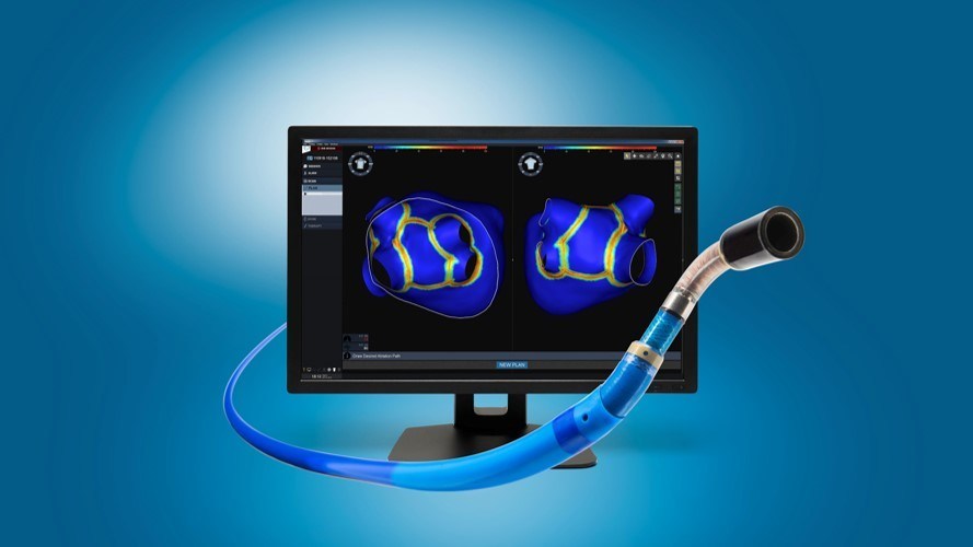 Vytronus LICU system in clinical development, with monitor showing catheter ablation lesion set for investigational treatment of persistent atrial fibrillation.