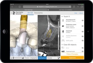 Dentsply Sirona Launches Azento®: Single Tooth Replacement in Canada