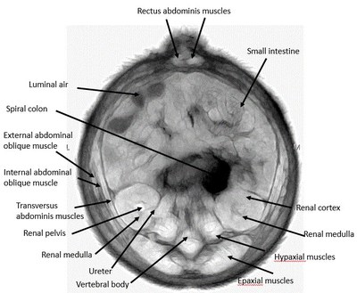 Fused QT Ultrasound 3D quantitative transmission ultrasound and compounded reflection axial images showing high resolution image of internal organs, tissue, skin and hair of neo-natal piglet. Anatomy courtesy of Dr. C. Ruoff, DVM.