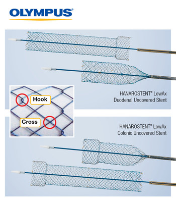 HANAROSTENT® LowAx™ Colonic and Duodenal Uncovered Stents are 510(K) cleared devices made by M.I. Tech and now distributed exclusively through Olympus in the U.S. Both are used for the treatment of strictures to improve quality of life.