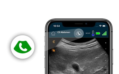 A single button activates Clarius Live while performing an ultrasound scan within the Clarius app