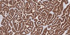Roche launches first in vitro diagnostic IHC test to detect ROS1 protein in cancers