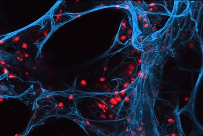 In the project Fraunhofer iCAIRTM, scientists are breaking new paths in the development of anti-infective therapies: for efficacy testing of new drug candidates, they use, for example, human precision-cut lung slices (PCLS). The image shows stained PCLS (blue) infected with influenza virus H1N1 (red).