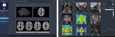 CE Certification for AI-based Medical Solutions of JLK Inspection: AI-based Brain Image Analysis (JBS-01K) and AI-based Prostate Image Analysis (JPC-01K) Solutions