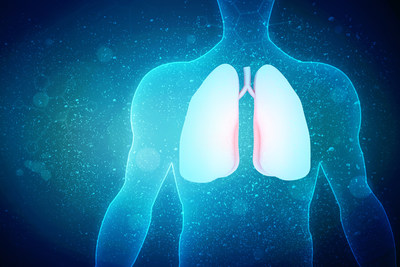 The Pulmonary Fibrosis Foundation (PFF) Patient Registry is now a significant resource designed to promote research and accelerate treatments for pulmonary fibrosis. Registry statistics are providing scientists with a better understanding of the PF patient profile, disease progression, and effectiveness of therapies. To date, 23 studies, including abstracts and manuscripts, have been developed or are underway using PFF Registry data. Collectively, this represents $30 million in disease research