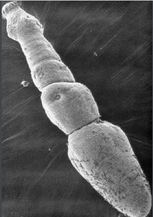 Echinococcus multilocularis: A tiny but terrible tapeworm