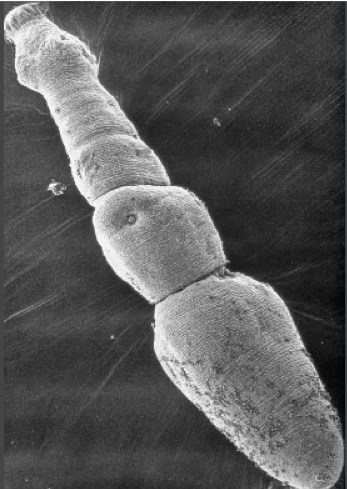 Echinococcus Multilocularis A Tiny But Terrible Tapeworm